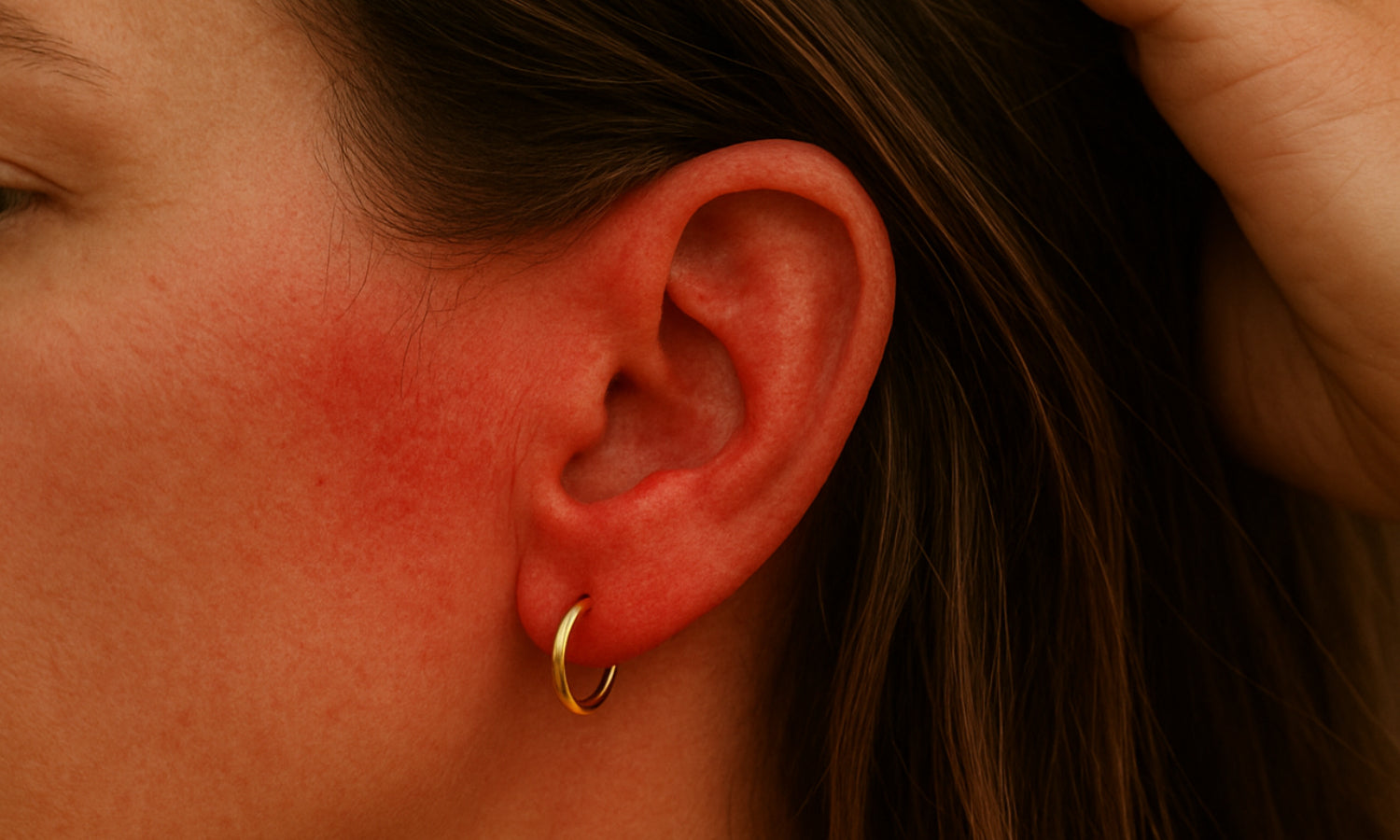 Close-up of a person's ear with a gold earring, showing redness on the skin around the ear.